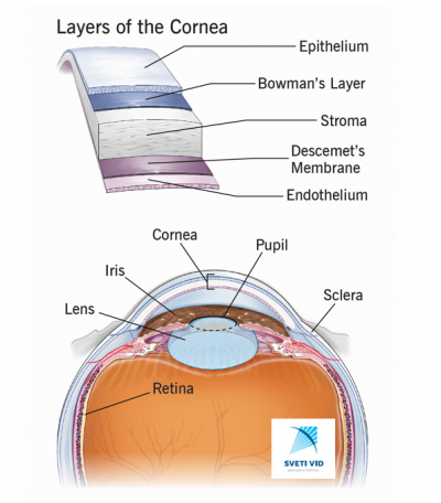 Corneal transplantation - Sveti Vid