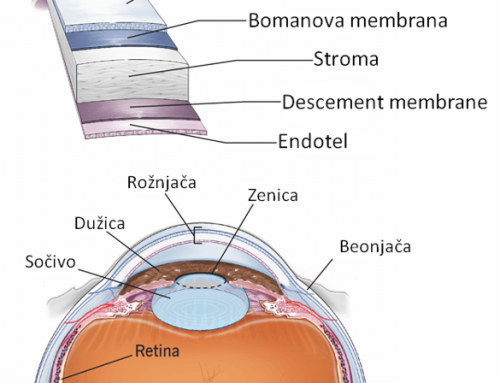Transplantacija rožnjače – indikacije
