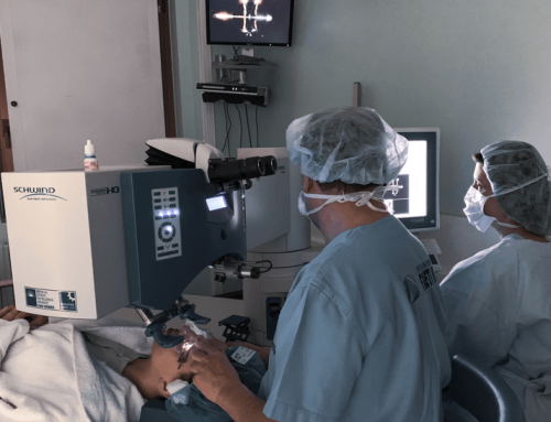 Kada se primenjuje laser u korekciji dioptrije?