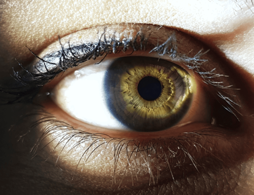 Ablacija mrežnjače – predisponirajuća stanja za njen nastanak